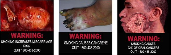 Smoke causes gangrene